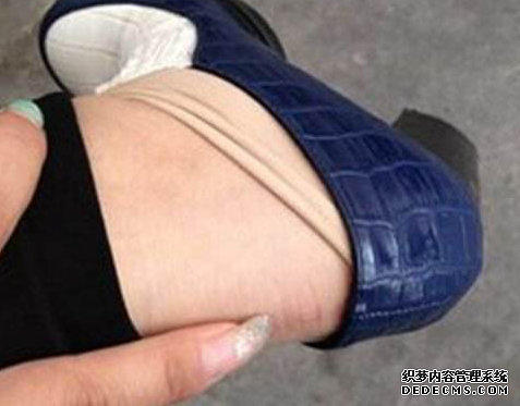 What to do when new shoes rub against your heels. How to deal with new shoes that rub against your heels